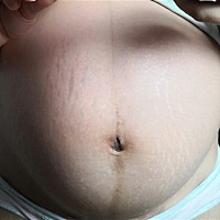 有会跟进肚子看性别的宝妈吗？怀孕8个月