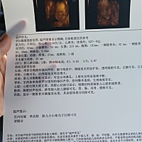 你们的四维也是这么丑么？鼻子为撒嫩大 🙄🙄🙄🙄