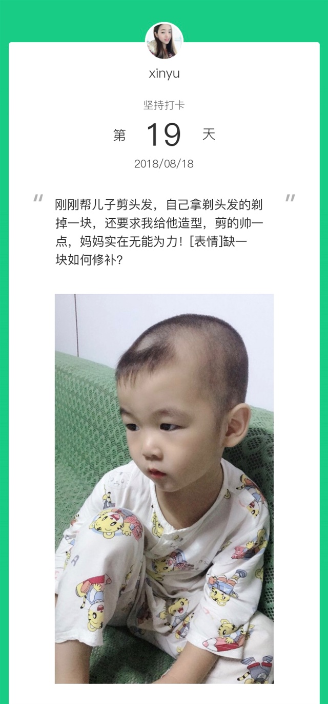 还知道臭美啦，缺陷也很美，哈哈！