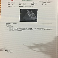 子宫内膜增厚，8月1号内膜增厚约17mm，8月20号去做b超厚约15mm，医生建议我做刮宫手术，还未结婚生孩子...
