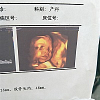 粑粑说宝宝长的好丑，好期待宝宝快点发动，现在己经38周了，很快就会见面了，