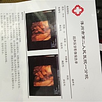 大家帮忙看看是男宝还是女宝