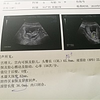 亲们，宫颈管是啥？为啥画个圈圈呀？