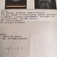 大家帮忙看看男宝还是女宝