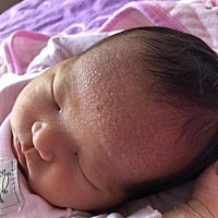 宝宝额头是什么啊？你们宝宝额头上是这样吗