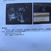 最近屁股疼。有会看男女的吗，不是在意男女，而是好奇……