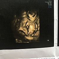 各位宝妈怀孕到怀孕5个月都重了多少呀，我肚子5个月和别人7个月一样，重了10斤，会不会太多了