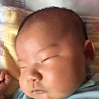 宝宝脸上长了很多小米粒似的小疙瘩，刚开始不多，后来越来越多，感觉她也不疼不痒？有知道是什么原因的么？