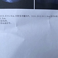 孕6周 1天，43天，B超未见胎心胎芽，见卵黄囊，正常吗？末次7.10日25号排卵的