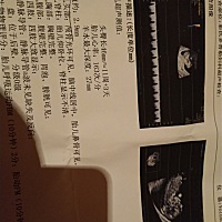宝宝11周3天了做了nt，nt值约厚2.9mm,医生说正常才2.5mm,我的太厚了，我好担心，才第一胎，好希望宝宝能...