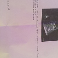 宝妈们帮我看看男女