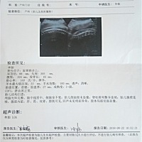 孕妈们帮忙看看能顺产吗