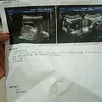 宝妈们，能不能给看一下是男宝还是女宝，谢谢了(^～^)