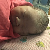 8月20号39+1那天开始宫缩．阵痛是真的痛，打了无痛好很多，想顺的建议打无痛，打了以后真的很轻松，我以...