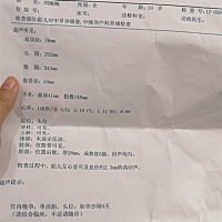 强光点有没有事。担心