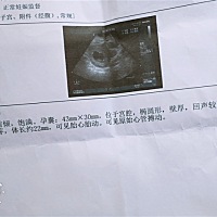 宝妈们，有谁可以看没，给我看看是男宝还是女宝😋😋第一胎是个女宝