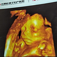 花钱检查三次都没有查出男女，不是屁股挡着就是大腿夹着，现在怀孕六个半月还是很好奇，有会看的吗？帮...