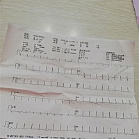 有谁会看心电图的