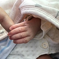 产后痔疮严重怎么办