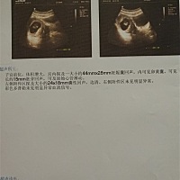 是男 是女帮忙看下