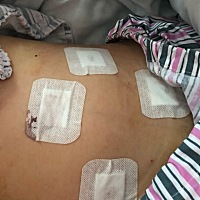 终于决定做腹腔镜手术把巧囊给拿掉😰                       手术日在星期二,星期一签手术单的时候医...