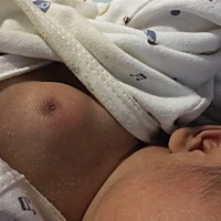 寶寶出生第十天了，為什麼寶寶的胸会又胀又硬的两個胸都一樣，又不会痛的，有知道什麼原因的寶妈吗？这...