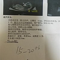 有没有大佬，这月份能看出来男女吗？