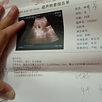 听说孕囊可以看出男女，各位亲们可以看得出来吗