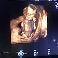 麻烦问一下谁会看男女呀！帮我看看性别，谢谢