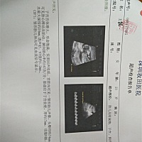 今天又到产检  好贵啊😂