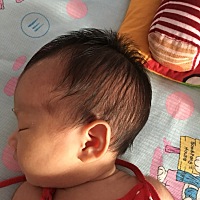 女儿出生后脑勺特别大，看了网上有种头部畸形叫舟状头，很担心，各位亲能帮我看看吗？这种头能睡下去吗？