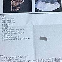 宝宝四维图出炉，同事说女孩，大伙看呢？娱乐一下，第一胎男女宝都一样是我的最爱