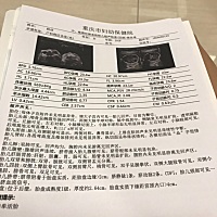 系统B超，一次性顺利通过✌️应该是个妹妹😊
