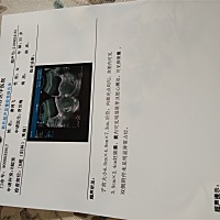 昨天下午刚做的B超，有胎芽胎心了心终于可以放下了