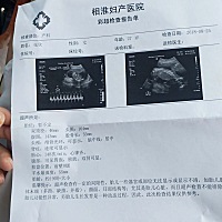 怀孕19周啦，能看出来男女吗？