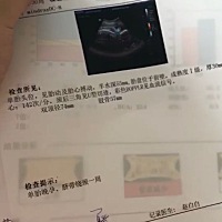 孕期32➕1，还有十几天8个月，有没有同款孕妈呀，还有50多天感觉好漫长……😂😂😂这个月13号的产...