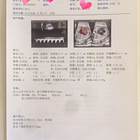 有谁能帮我看看宝宝性别？期待