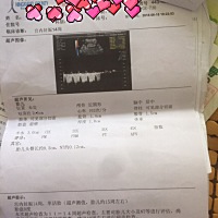 不知道是男宝还是女的，很期待，有谁会看😀