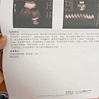 帮忙看下是男宝女宝？？有谁会看么