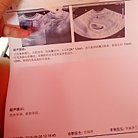 好像很正常。开心。不过医生说宝宝大概52天，我自己算有60天了，没问题吧？