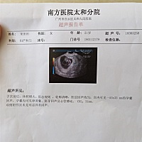 谁会看这是双胎还是单胎.，忘记问医生，如果是双胎我想医生应该也会说的