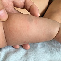 宝宝三个月，这是怎么了