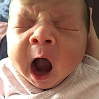 快出月子了 我起了一身痱子 还剩最后两天 身上头上都痒死了，不停的挠还是很痒 长这么大第一次出痱子。...