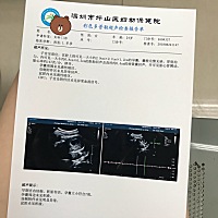 今天照的B超😊