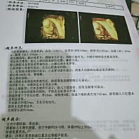 很好奇，想知道是男宝宝还是女宝宝