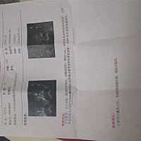 这是今天检查的，医生说让我明天晚上同房，后天在去复查一下，我跟老公都想要孩子半年一直没有，心里好...