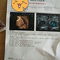 猜男女，一胎纯属好奇心。