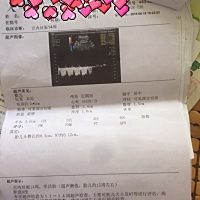 有谁会看男女吗？十分期待！辛苦各位准妈妈了