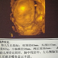 像男孩还是女孩？？？