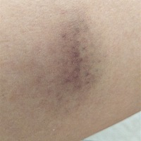 为了别的女人，竟然动手打我！不顾及我也丝毫不顾及肚子里宝宝！都让去做伤情鉴定，可是终究还是不忍心...